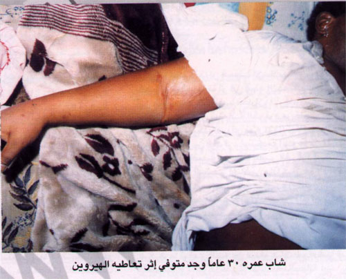 مدمن30عاما متوفى .. اضغط لتكبير الصورة